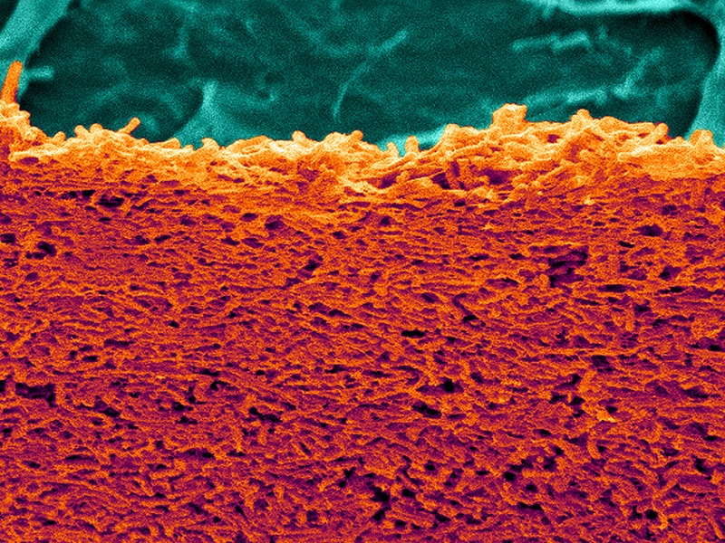 fda approves zinplava for preventing return of c diff