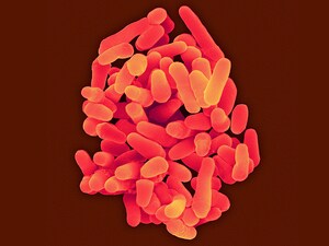 Drug-Resistant Tuberculosis on the Rise in Eastern Europe