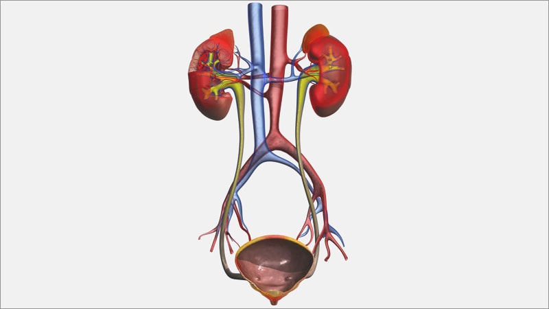 Fast Five Quiz: Bladder Cancer Presentation and Diagnosis