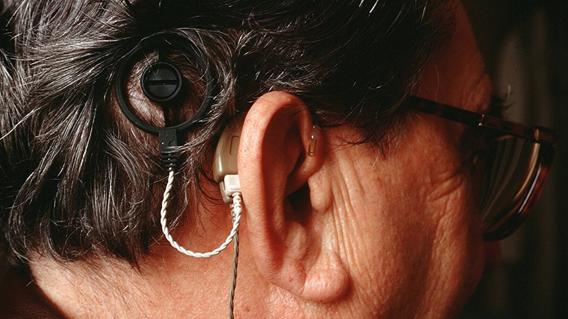 International Consensus Supports Wider Use Of Cochlear Implants