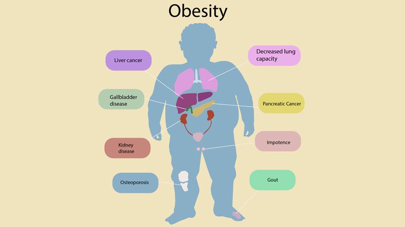 Obesity and weight-related comorbidities