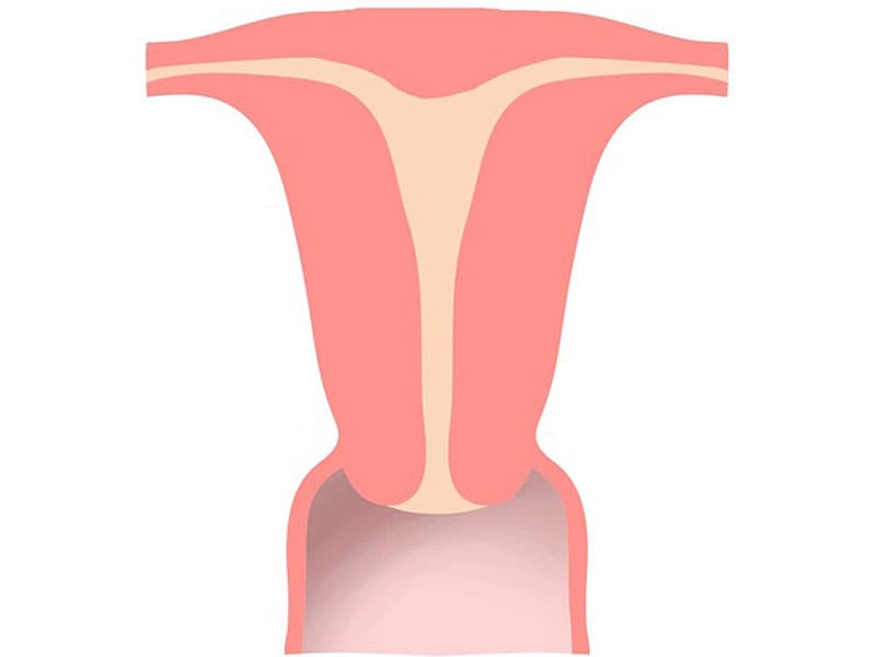 Женские эндометрии. Гипоплазия матки.