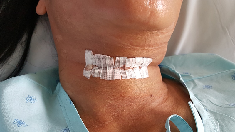 Thyroid Surgery Readmissions Pay Close Attention To Calcium thyroid-surgery-readmissions-pay-close-attention-to-calcium