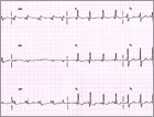 A Dangerous Diagnosis in an Asymptomatic Patient: Case Quiz