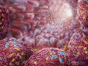 Microbiome May Predict Colon Cancer Tumor Mutational Status
