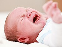 Infantile colic sale medscape