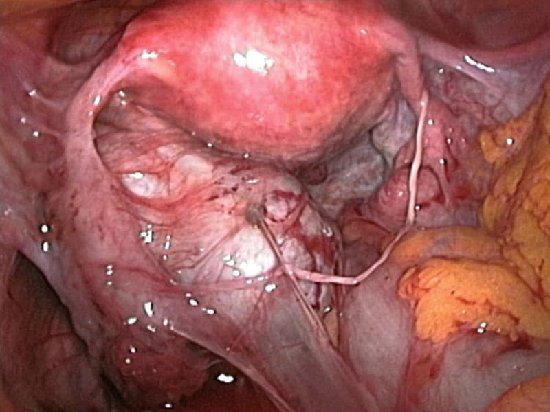 read cellular and molecular aspects of implantation 1981