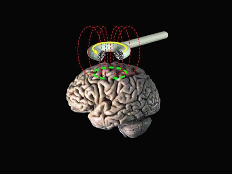 Как стимулировать мозг. ТМС мозга. Транскраниальная магнитная стимуляция головного мозга. Магнитное поле мозга.